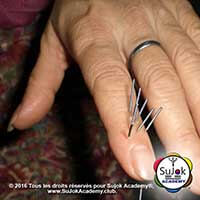 Les principes fondamentaux et l'explication de la Su Jok thérapie